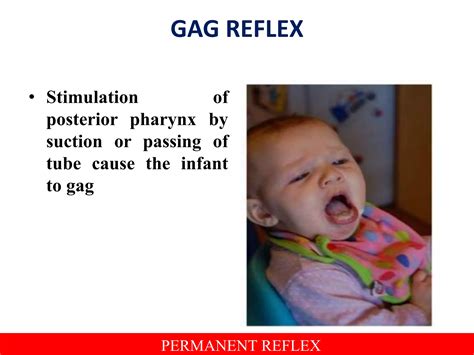 ASSESSMENT OF NEWBORN REFLEXES | PPTX
