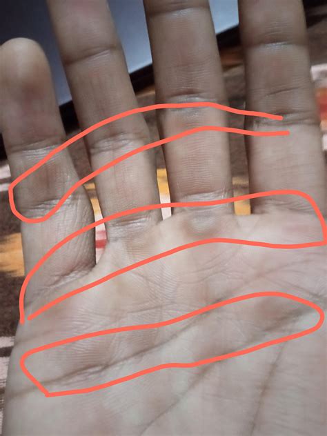 How do you guys manage calluses? They're creeping all over my hands and