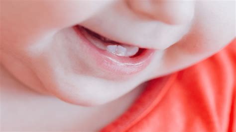 Dor De Dente No Bebe - Nascimento dos dentes do bebê: 6 dicas para diminuir a dor