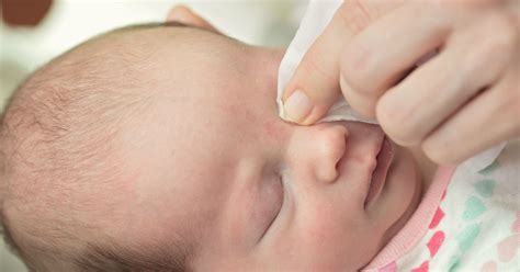 Conjuntivite Bebe 1 Ano - Conjuntivite em bebê: sintomas e como tratar - Minha Vida