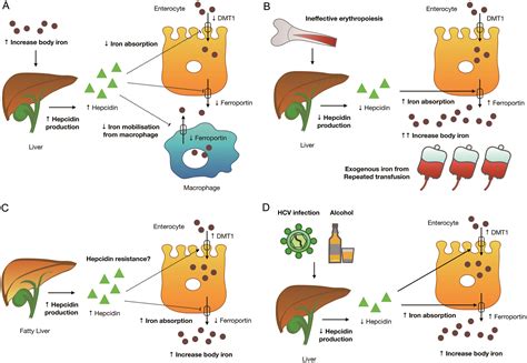 Secondary Iron Overload and the Liver: A Comprehensive Review