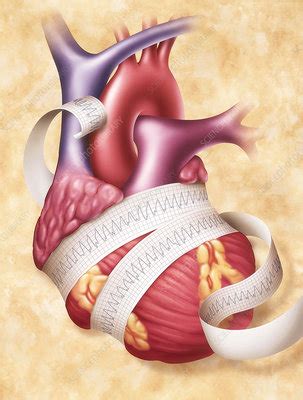 tachycardia stock image  science photo library