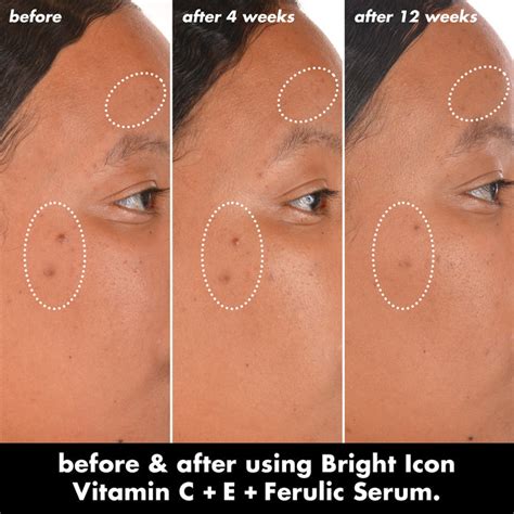 bright icon brightening vitamin  serum  ferulic acid elf