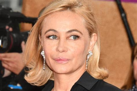 Emmanuelle Beart Plastic Surgery