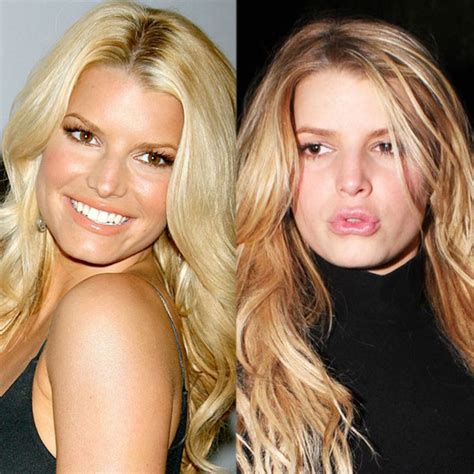 Jessica Simpson Plastic Surgery: The Astonishing Transformation - Versus TV