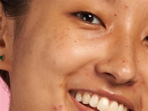 ultimate guide   type  dark spot