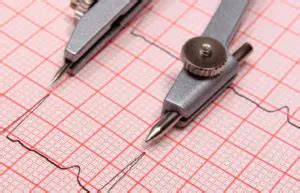 Unravelling the EKGs Understanding EKG Rhythms Chart Explained ...