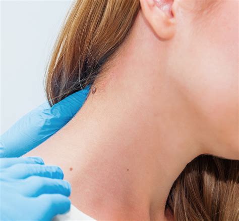 About Us | Johns Creek Dermatology