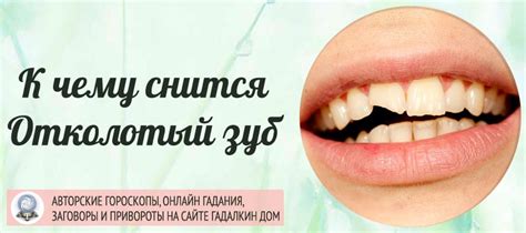 Сонник: откололся зуб