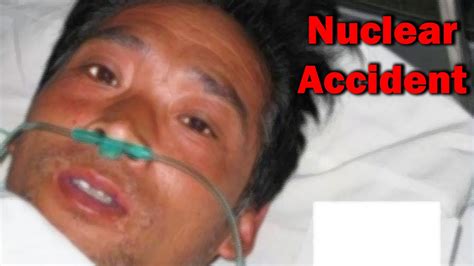The Most Radioactive Man in History - Hisashi Ouchi - YouTube