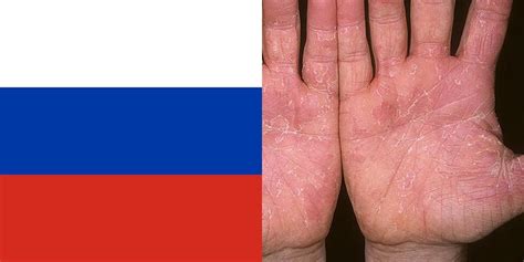 Skin Disease in Russia