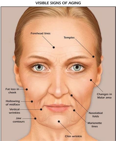 Image result for anatomy face | Facial aging, Aging signs, Dermal fillers