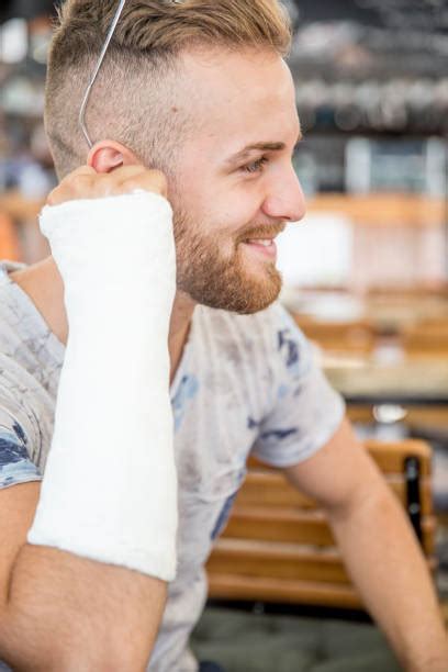 upper body cast stock  pictures royalty  images istock
