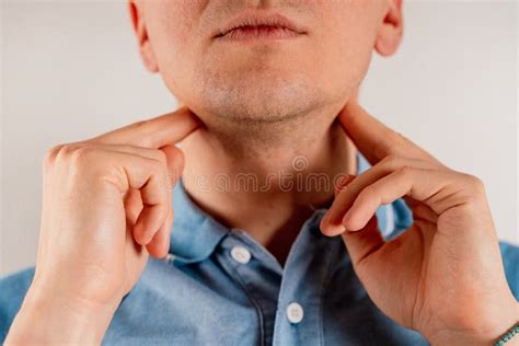 Submandibular Lymph Nodes Swollen