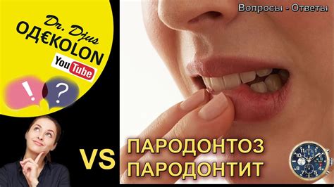 ПАРОДОНТОЗ vs ПАРОДОНТИТ: В чем разница и советы, как правильно чистить ...