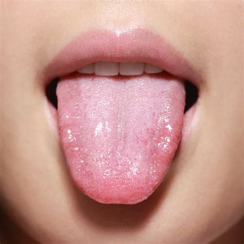 What Does A Healthy Tongue Look Like