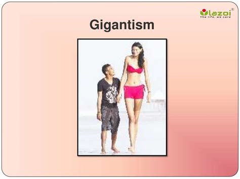 Gigantism