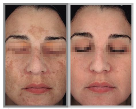 cosmelan oasis wellbeing clinic