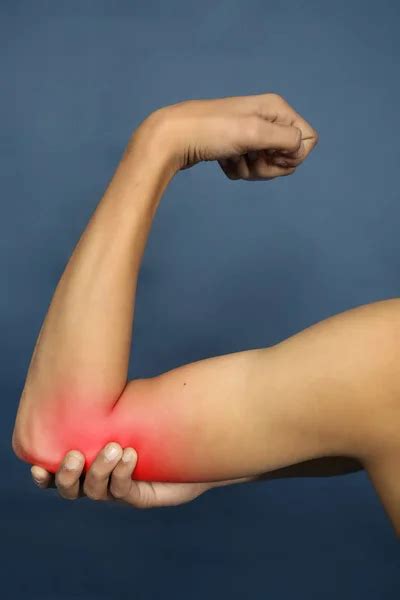 Ulnar nerve injuries: картинки, стокові Ulnar nerve injuries фотографії ...
