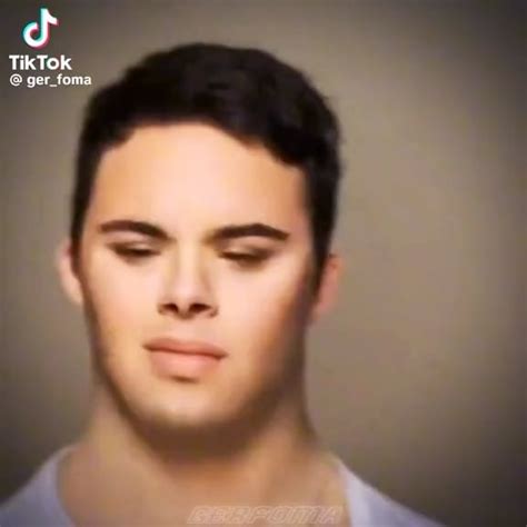 syndrome mogger rmewing