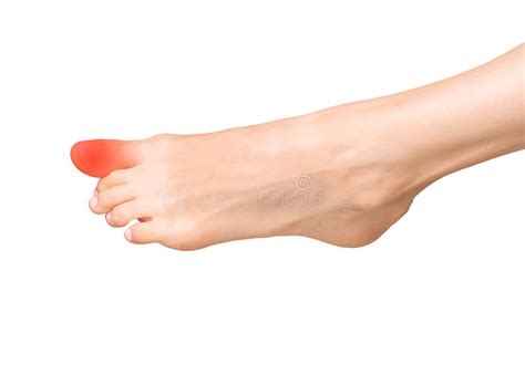 Big Toe Pain, Joint Ache, and Inflammation. Sore Foot with Sprain ...