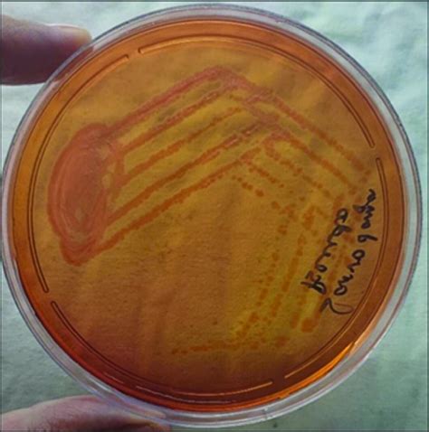 MacConkey Agar showing non-lactose fermenting colonies of A.hydrophila. | Download Scientific ...