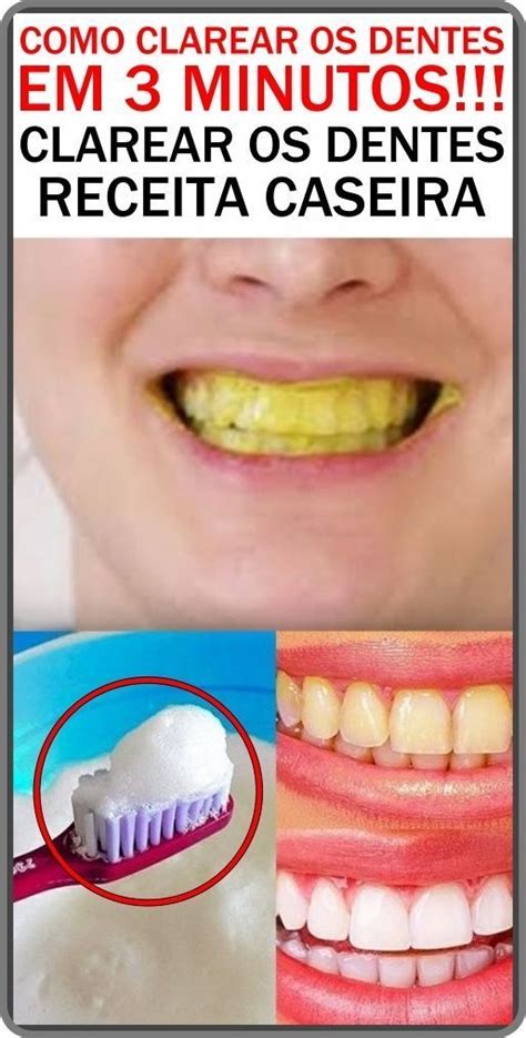 Como Clarear O Dente Caseiro - Receita de Receita Caseira Para Clareamento dos Dentes! | Remédios para ...