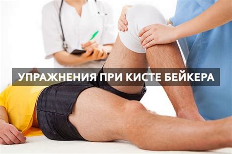 Упражнения при кисте Бейкера коленного сустава: лечебная гимнастика