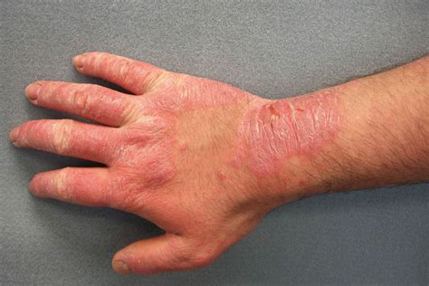 19 Possible Causes of Concerning Red Spots