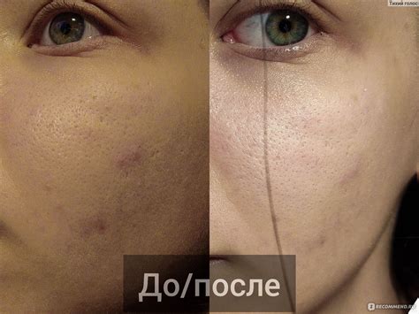 Гель-крем для лица Ив Роше / Yves Rocher Hydra Vegetal 48H Non-Stop ...