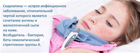 Скарлатина: причины, симптомы, лечение, профилактика