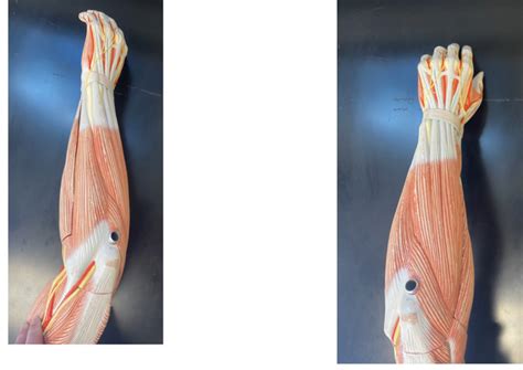 Lab 5 - Posterior Antebrachium Diagram | Quizlet