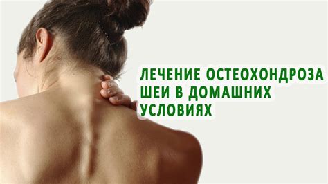 Как дома можно лечить шейный остеохондроз? - YouTube