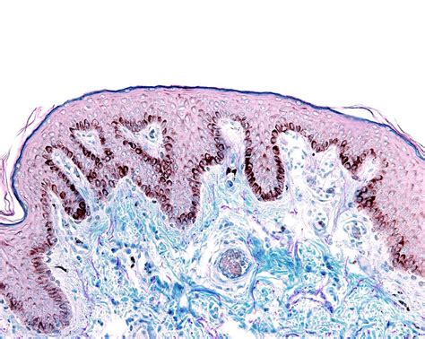 nipple skin   science photo library
