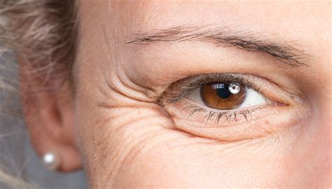Wrinkles Treatment (Botox, Dysport) - USHINE-POLYCLINIC