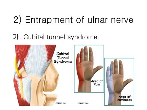 affections   elbow  hand powerpoint