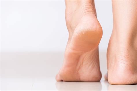 cara menghilangkan bulu kaki dengan garam 11