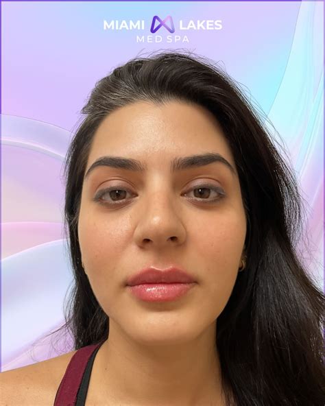 Miami Lakes Med Spa | Miami Lakes FL