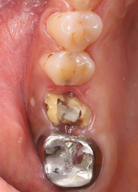 Một bác sỹ đàn anh cao thủ... - Sách Ovate Pontic Dr Minh