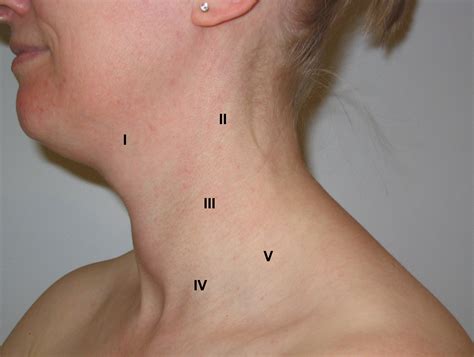 axillary lymph nodes cancerous vrogueco