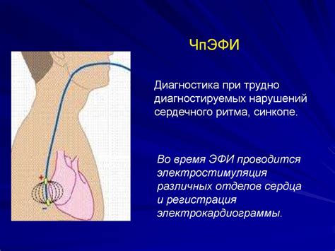 Актуальные и современные проблемы детской кардиологии - презентация онлайн