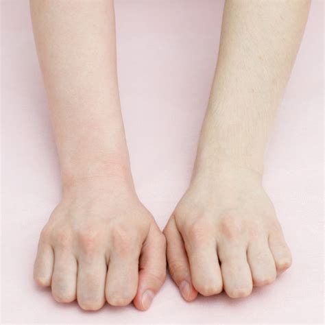 arm