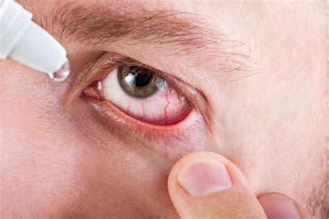 3 common eye problems and what to do about them | Stuart P. Sondheimer, MD