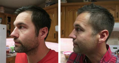 Souirensu It Works: See the Amazing Before & After Results - 8vjnbfk