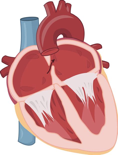 Patent foramen ovale (PFO) - Hartcentrum Hasselt