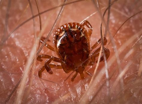 Best Insect Repellents | Green Giant Home & Commercial