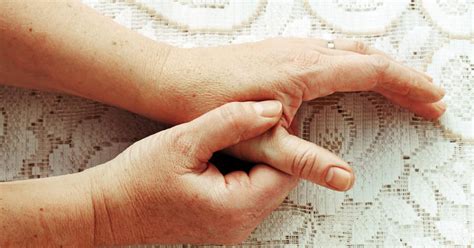 sprained thumbs  fingers mandurah physiotherapy