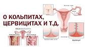 Кольпит лечение. Как лечить кольпит народными средствами. - YouTube
