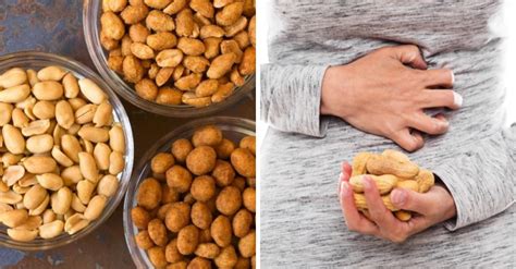 Comer Amendoim A Noite Faz Mal - Amendoim faz mal, sim ou não?