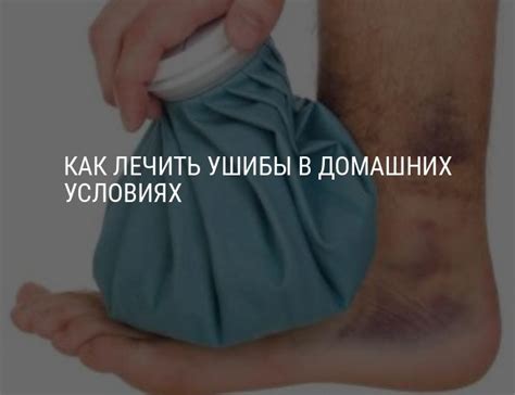 Лечение ушибов рук, суставов, головы, шеи, спины, грудной клетки и ...